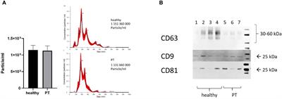 Release of exosomes in polytraumatized patients: The injury pattern is reflected by the surface epitopes